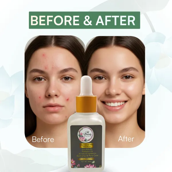 Niacinamide_10%_Zinc_Pca_Pore_Refining_Face_Serum