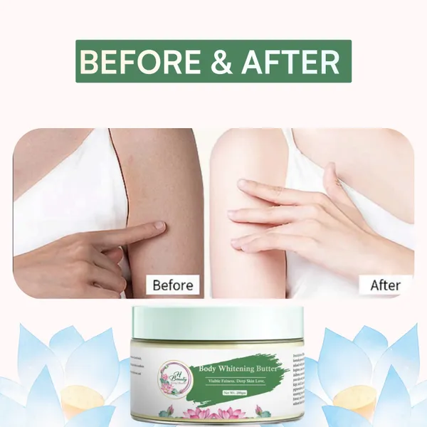 Kojic_Acid_Aha_Whitening_Body_Butter