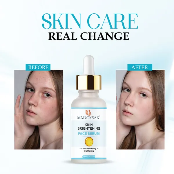 Madonnax_Skin_Brightening_Glow_Enhancement_Face_Serum_30Ml