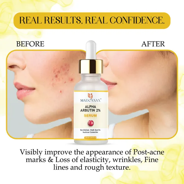 Madonnax_Alpha_Arbutin_2%_+_Hyaluronic_Acid_Dark_Spot_Brightening_Serum_30Ml