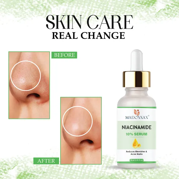 Madonnax_Niacinamide_10%_Pore_Minimising_Blemish_Reduction_Face_Serum_30Ml