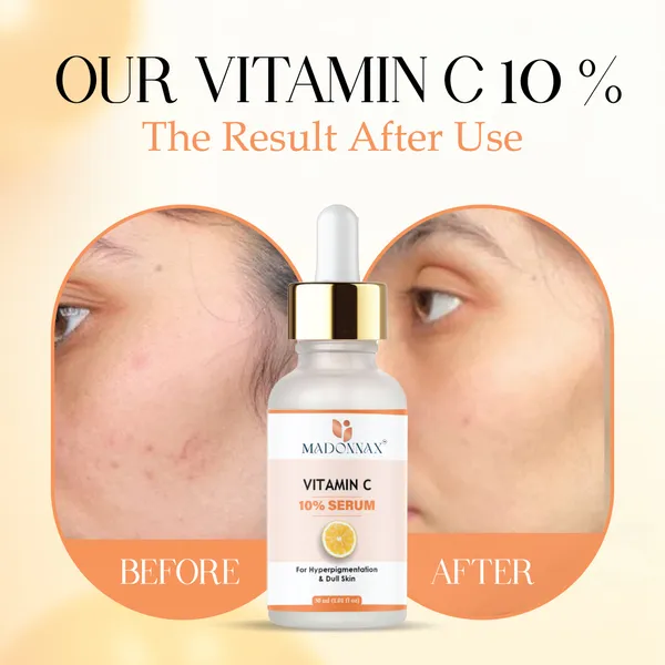 Madonnax_Vitamin_C_10%_Brightening_&_Hyperpigmentation_Face_Serum_30Ml