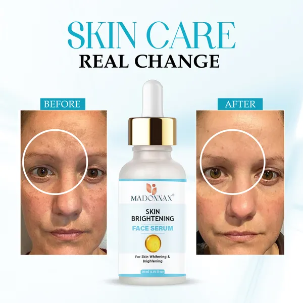 Madonnax_Skin_Brightening_Glow_Enhancement_Face_Serum_30Ml