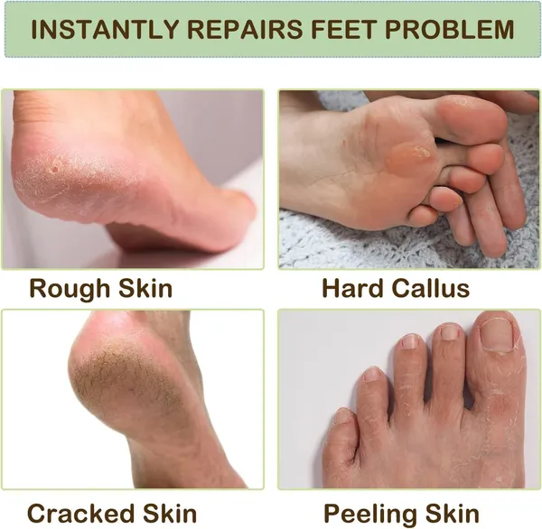 Silicone_Socks_For_Women_Men_Crack_Heel_Repair_Spa_Gel_Socks_With_Vitamin_E_Moisturizing_Hydration_Socks_For_Dry_Cracked_Feet_Reusable_Soft_Silicone_Heel_Socks_For_Foot_Care_Nourishment_Mulitcolor