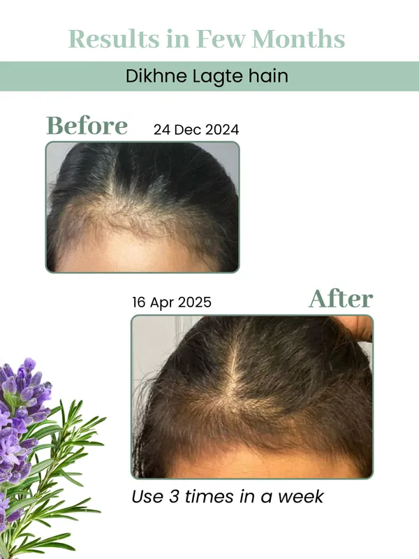 Biobird_Rosemary_Hair_Growth_Oil_100ml_(Pack_Of_2)