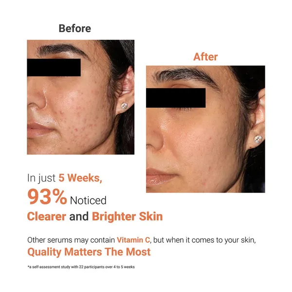 Biobird_10_Vitamin_C_Face_Serum_For_Dark_Spots
