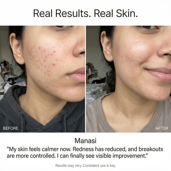 Flawless_Glow_Face_Serum