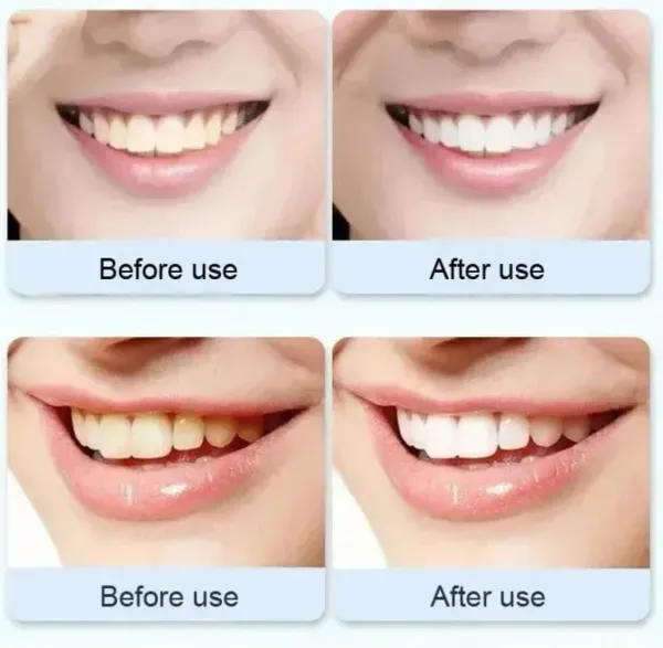 Original_Probiotic_Ultra_Sp_4_Whitening_Toothpaste_For_Stain_Removal,_Bad_Breath_And_Maintain_Oral_Health