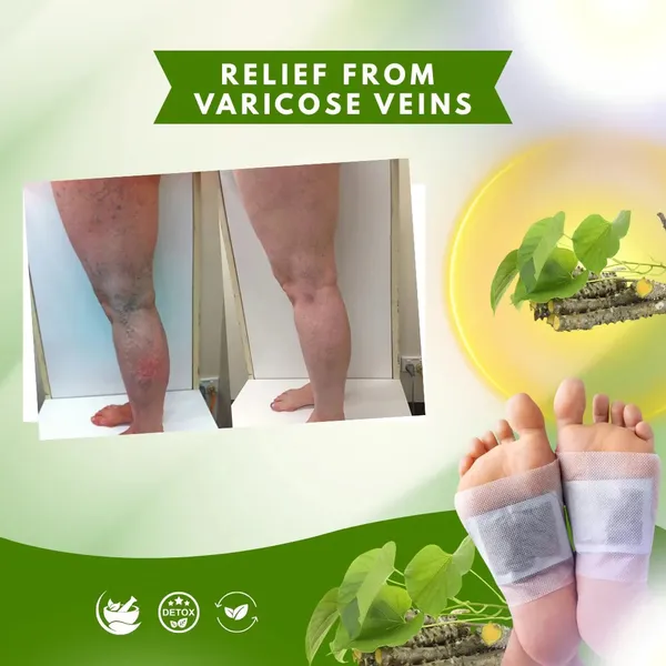 Herbal_Giloy_Detox_Foot_Patch_(_Buy_1_Get_1_Free=_Pack_Of_2)