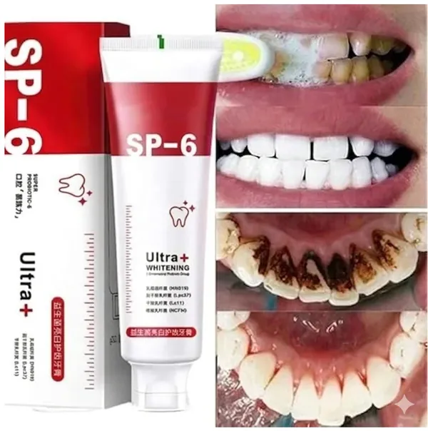 Sp-6_Whitening_Toothpaste_|_Probiotic_Teeth_Whitening_For_Stains,_Bad_Breath_&_Gum_Health