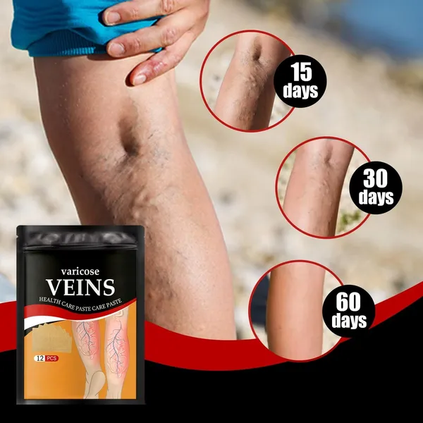 Varicose_Veins_Patches_Skin-Friendly_Non-Toxic_Improve_Varicosity_Dredge_Vein_Relieve_Soothe_Swelling_Pain_Instant_Relief_From_Muscular_Pain_&_Joint_Pain