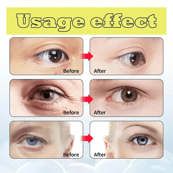 Celimax_Vitamin_A_Retinal_Shot_Tightening_Booster_0.5_Fl_Oz_(15_Ml),_Serum_Introduction,_Needle_Serum,_Retinol,_Vitamin_A,_Niacinamide,_Pores,_Wrinkles,_Small_Wrinkles,_Aging_Care,_Mother'S_Day_Gift