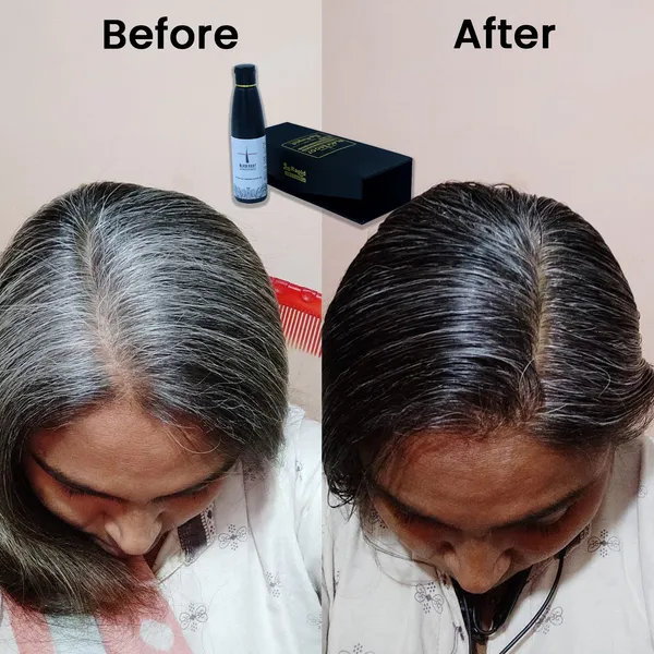 Black_Root_Natural_Hair_Oil_100ml_+_Free_Shampoo_50ml