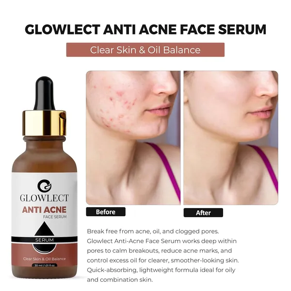 Anti_Acne_Face_Serum_With_Salicylic_Acid_And_Niacinamide