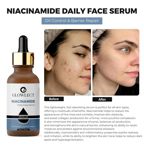 Niacinamide_Face_Serum