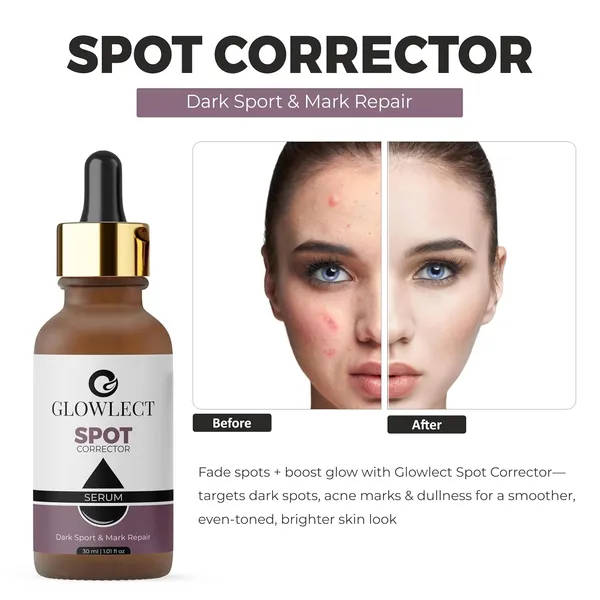 Face_Serum_For_Dark_Spots_And_Hyperpigmentation
