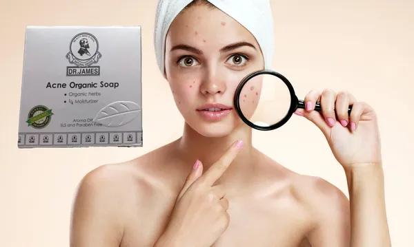 Dr_James_Acne_Organic_Soap