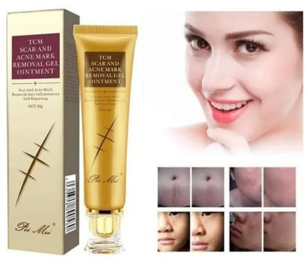 Pei_Mei_Scar_Acne_Mark_Removeal_Gel_Ointment_30_G