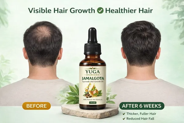 Yuga_Ayurveda_Jamalgota_Amla_Bhringraj_Hair_Growth_Oil_30_Ml
