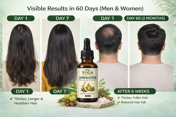 Yuga_Ayurveda_Jamalgota_Amla_Bhringraj_Hair_Growth_Oil_30_Ml