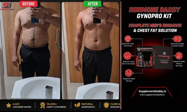 Hormone_Daddy_Pro_Kit_(_GYNO_KIT_)