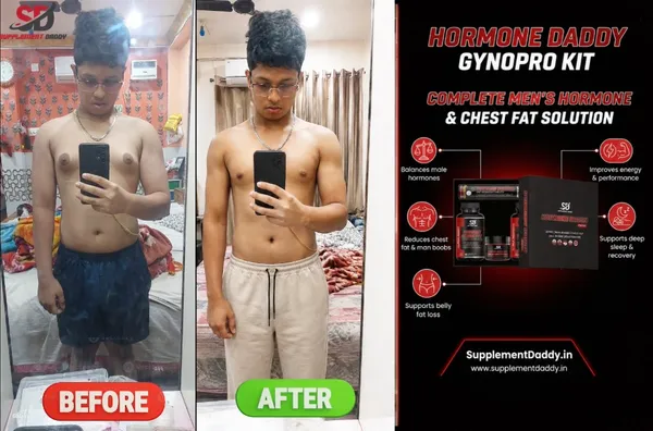 Hormone_Daddy_Pro_Kit_(_GYNO_KIT_)