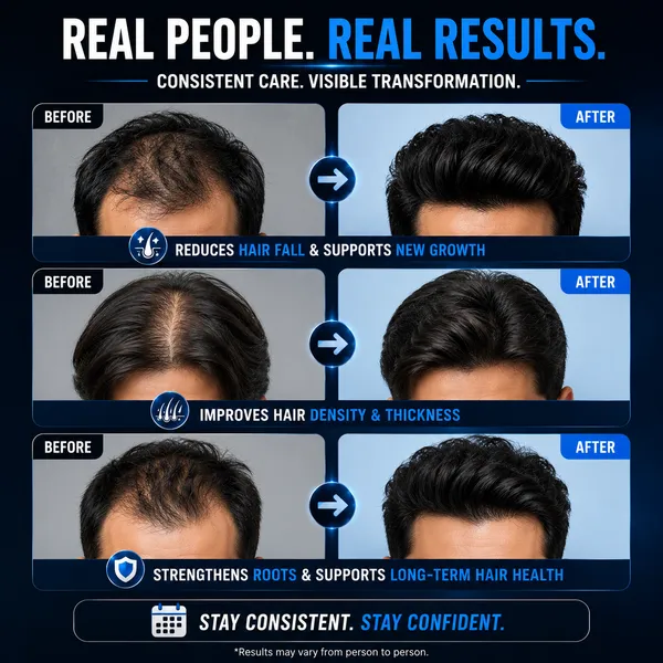 Triczen_Advanced_Male_Hair_Regrowth_Supplement_60_Capsule