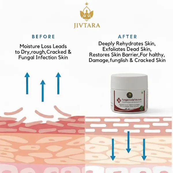 Jivtara_Ayurvedic_Antifungal_Therapy_Balm_Neem_And_Turmeric
