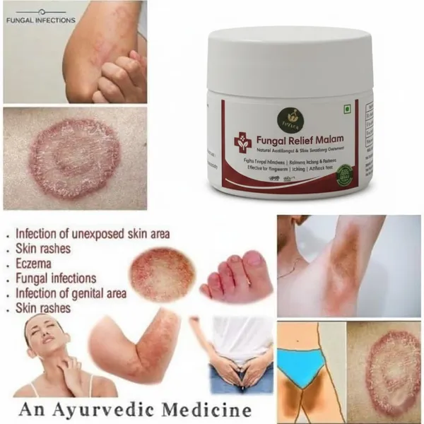 Jivtara_Ayurvedic_Antifungal_Therapy_Balm_Neem_And_Turmeric