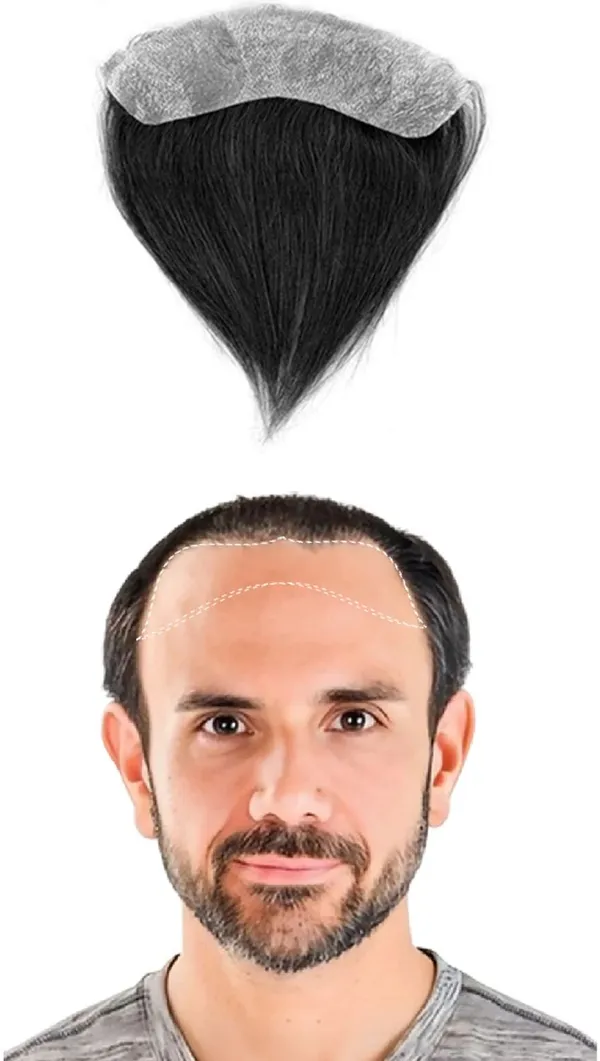 Frontal_Hairline_Human_Hair_Wig_Patch