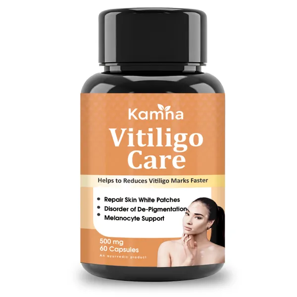 Vitiligo_Care_Capsules_Shatavari_Ashwagandha_Turmeric