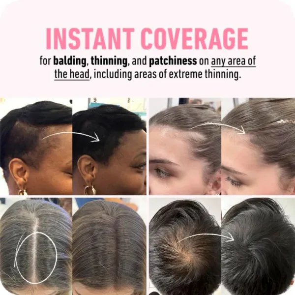 Boldify_Hair_Building_Fibers_Powder_For_Hair_Loss_Coverage