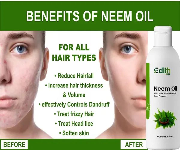 Edith_Naturals_Multipurpose_Pure_Neem_Oil_For_Hair_Skin_Remove_Pimples_Acne_And_Cure_Any_Fungal_Infection_From_Skin_100_Ml_2_-_Pack_Of_2