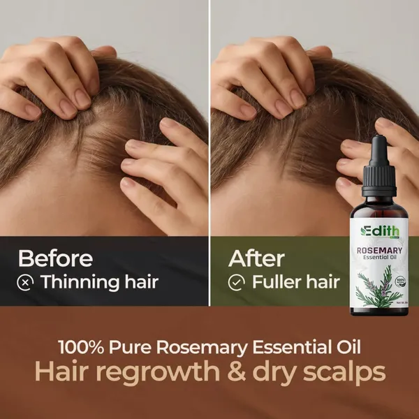 Edith_Naturals_Rosemary_Essential_Oil_30ml_100%_Pure_&_Natural_Rosemary_Oil_for_Hair_Growth,_Scalp_Care,_Hair_Strengthening,_Aromatherapy,_Massage,_Diffuser_&_Skin_Care