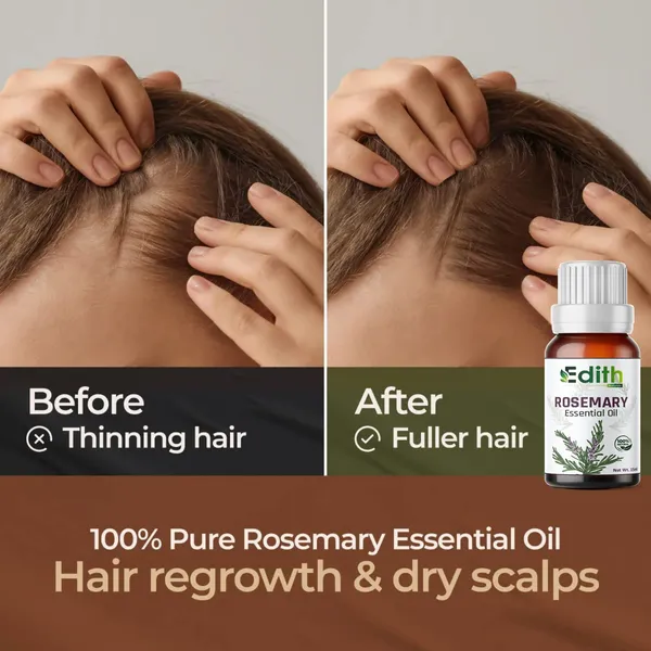 Edith_Naturals_Pure_Rosemary_Essential_Oil_15ml_And_Pure_Castor_Oil_100_ml_For_Hair_Skin_Growth_Combo_In_1_Pack_Of_2