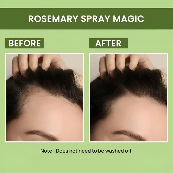 Rosemary_Water_Hair_Spray_For_Regrowth_Hair_Growth_Expert_Spray_Gift_Set_100ml_Bottles_Pack_Of_2
