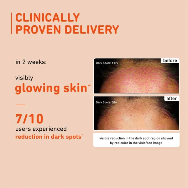 Edith_Naturals_15_Vitamin_C_Face_Serum_For_Glowing_Skin_Pigmentation_Dark_Spot_Removal_-_Pack_Of_2