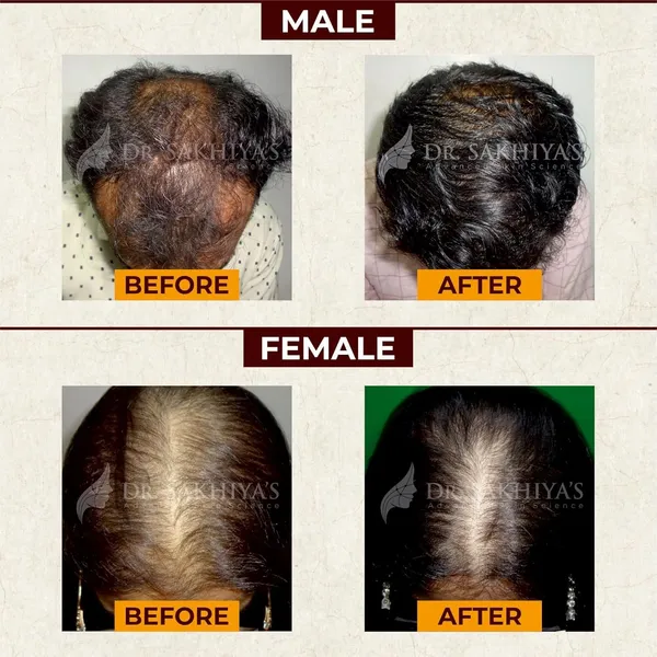 Edith_Jadibuti_Hair_Oil_Amla_Brahmi_Bhringraj_Vertiver_Root_Ayurvedic_Clinically_Proven_18_Oil_Blend_Reduces_Hair_Fall_Breakage_Strengthens_Roots_For_All_Hair_Types_100_Ml_Pack_Of_2