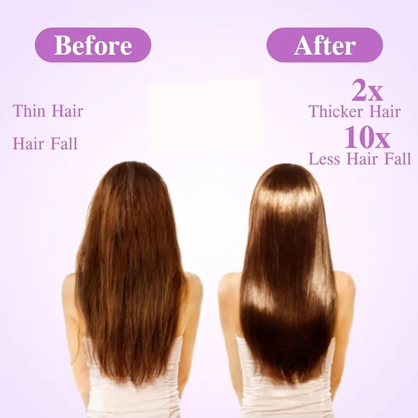 Edith_Rosemary_Hair_Oil_For_Hair_Growth_And_Hair_Fall_Control_200ml_Pack_Of_2