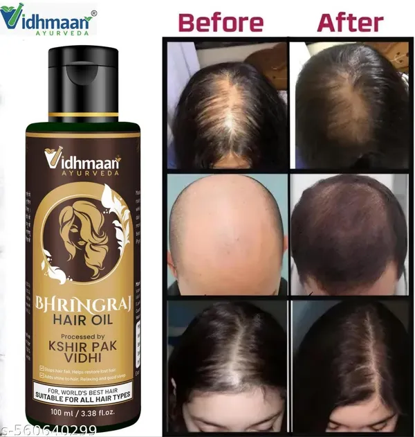 Vidhmaani_Ayurveda_Bhringraj_Hair_Oil_Reduces_Hair_Fall_And_Grows_New_Hair_100_Ayurvedic_Oil_100Ml_-_Pack_Of_2
