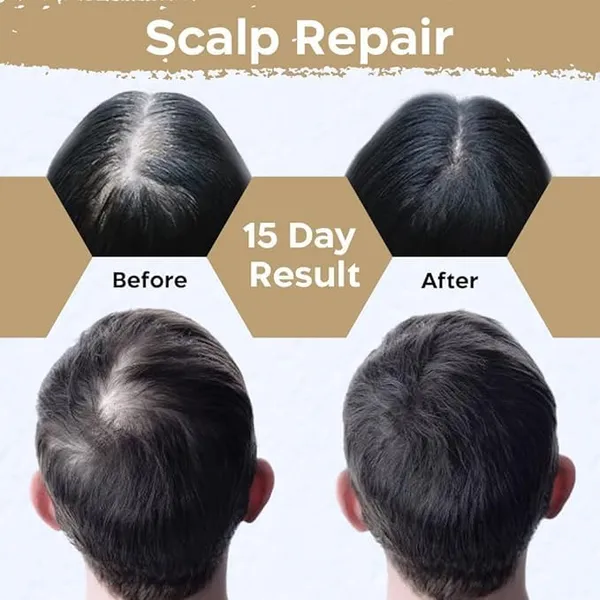 Vidhmaani_Ayurveda_Bhringraj_Hair_Oil_Reduces_Hair_Fall_And_Grows_New_Hair_100_Ayurvedic_Oil_100Ml_-_Pack_Of_2