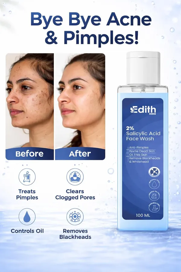 Edith_2_Salicylic_Acid_Face_Wash_Anti_Pimples_Removes_Blackheads_Oil_Free_Skin_Alcohol_Free_100_Ml_Pack_Of_3