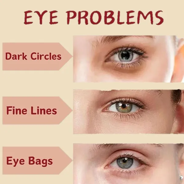 Edith_Naturals_Under_Eye_Roll_On_Cream_With_Coffee_Extract_For_Dark_Circles_Puffiness_Fine_Lines_Cooling_Roller_Eye_Serum_For_Men_Women_15_Ml_Pack_2