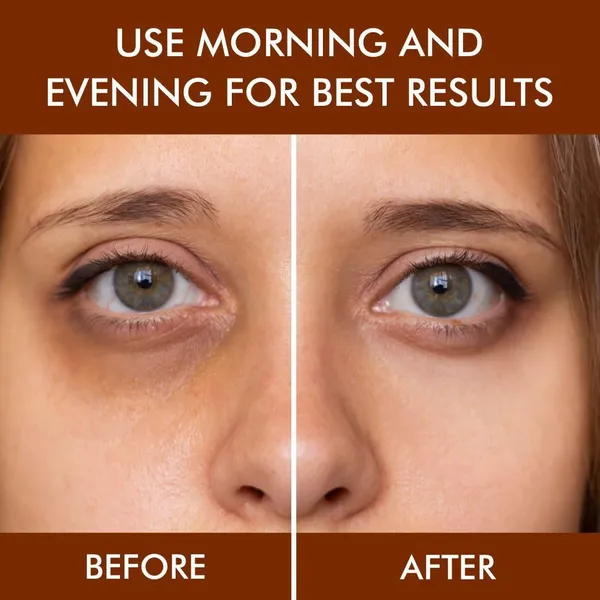 Edith_Naturals_Under_Eye_Roll_On_Cream_With_Coffee_Extract_For_Dark_Circles_Puffiness_Fine_Lines_Cooling_Roller_Eye_Serum_For_Men_Women_15_Ml_Pack_2