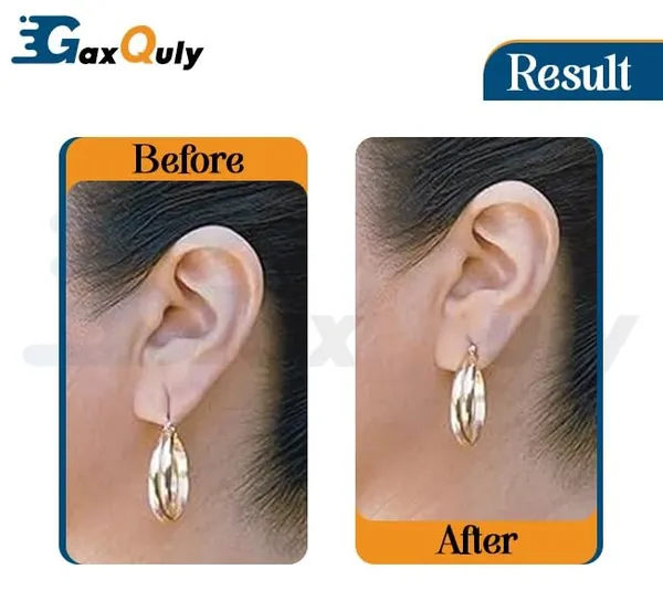Ear_Lobe_Support_Patches_-_Pack_of_2