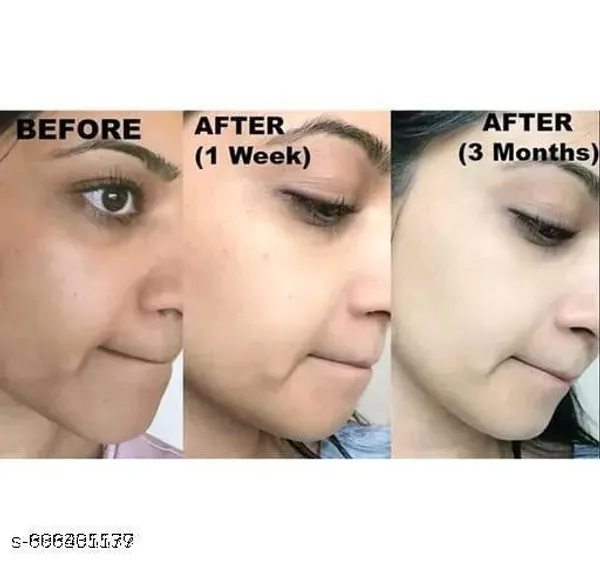Kojic_Acid_Skin_Brightening_Whitening_Bathing_Soap_100_G_Pack_Of_2