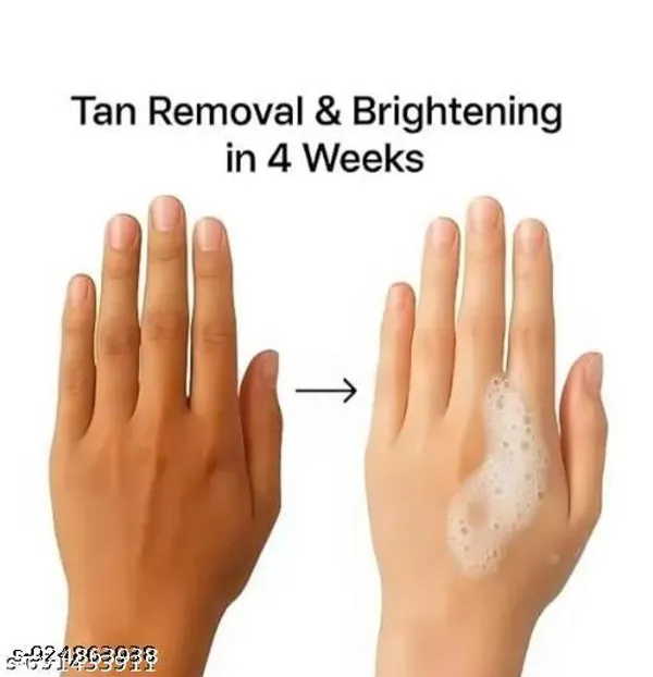 Niacinamide_Skin_Lightening_Dark_Spot_Removal_Face_Soap_Pack_Of_4
