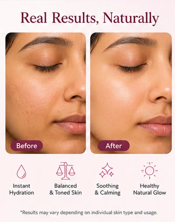 Rose_Hydrosol_Mist