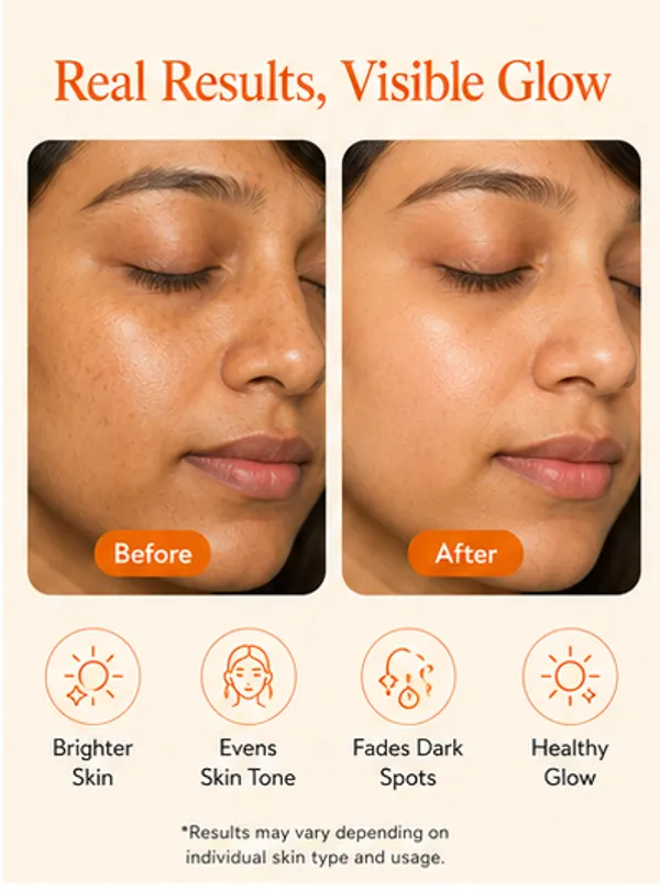 Vitamin_C_Glow_Drop