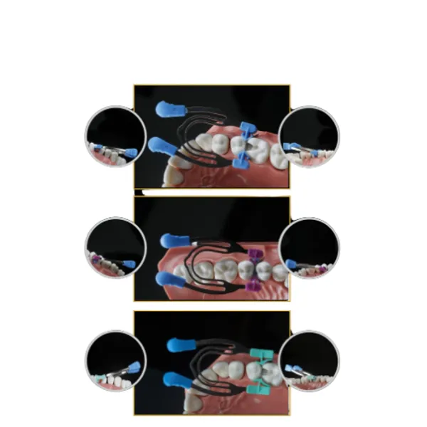 Twin_Force_Kit